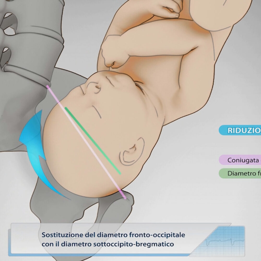 natural-childbirth-012